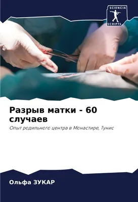 Produktbild von Razryw matki - 60 sluchaew