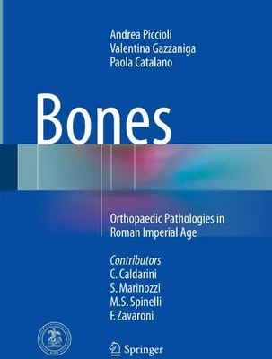 Obrázok produktu pre Bones