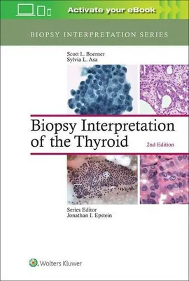 Obrázek produktu pro Boerner, S: Biopsy Interpretation of the Thyroid
