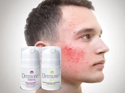 Produktbild von Dermione® - PFLEGEPAKET FÜR ZU PERIORALER DERMATITIS NEIGENDE HAUT