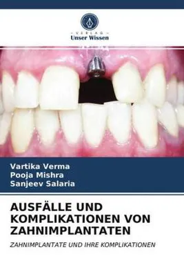 Produktbild von Ausfälle Und Komplikationen Von Zahnimplantaten