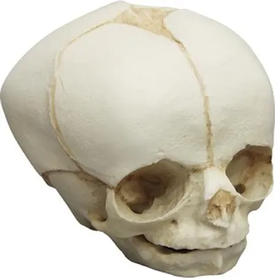 Image de Crâne fœtal, 30 semaines