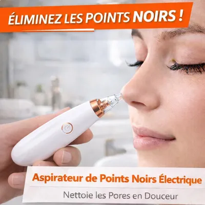 Image de Aspirateur de Points Noirs Électrique