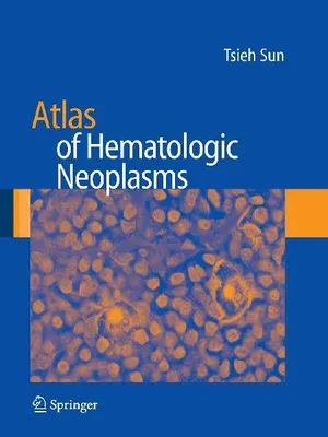 Produktbild von Atlas of Hematologic Neoplasms