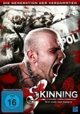 Produktbild von Skinning - Wir sind das Gesetz