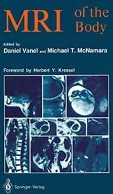 Produktbild von MRI of the Body