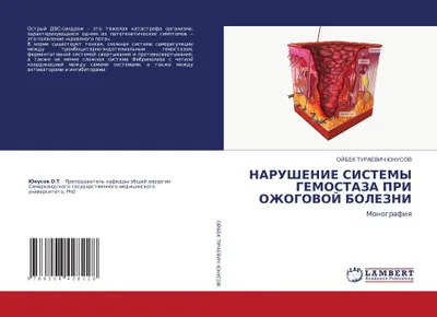 Produktbild von NARUShENIE SISTEMY GEMOSTAZA PRI OZhOGOVOJ BOLEZNI