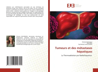 Produktbild von Tumeurs et des métastases hépatiques