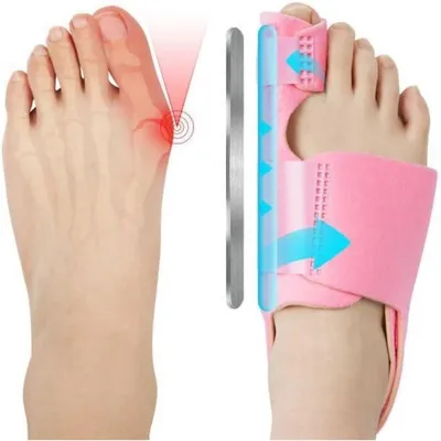Productafbeelding van Hallux valgus correctiebrace, teenvormers, dames/heren, roze