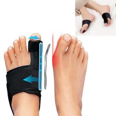 Produktbild von Hallux Valgus Korrektur Orthese,Zehenspreizer mit abnehmbarem Fersenriemen und Zehenkorrektur,Zehentrenner für Tag und Nacht