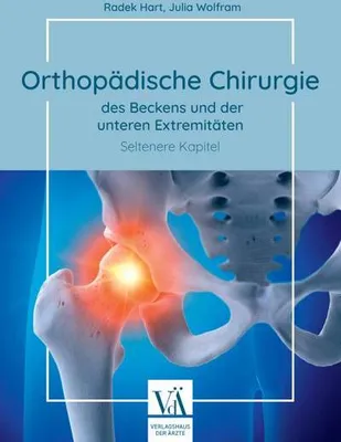 Immagine prodotto di Orthopädische Chirurgie des Beckens und der unteren Extremitäten