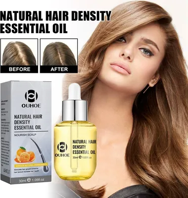 Produktbild von 30ml Ingwer Haarwachstumsserum ätherisches Öl stoppt Haarausfall, Haarwachstumsöl