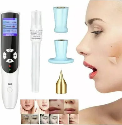 Produktbild von Tragbarer Stift Zur Entfernung Von Muttermalen, Plasma-Hautlifting-Stift, Anti Falten Warze Sommersprosse Faltenentfernung Haut Maulwurf Dunkler Fleckentferner Face Lifting