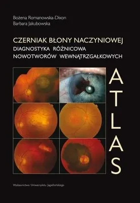 Imagen del producto de Czerniak blony naczyniowej Diagnostyka roznicowa nowotworow wewnatrzgalkowych