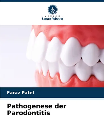 Produktbild von Pathogenese der Parodontitis