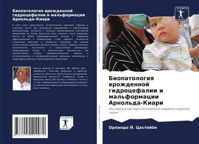 Produktbild von Biopatologiq wrozhdennoj gidrocefalii i mal'formacii Arnol'da-Kiari
