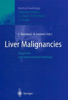 Produktbild von Liver Malignancies