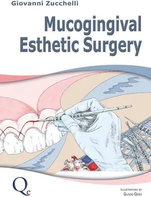 Immagine prodotto di Mucogingival Esthetic Surgery