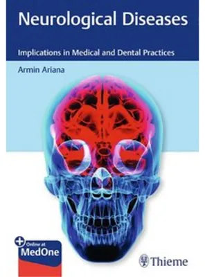 Obrázek produktu pro Neurological Diseases
