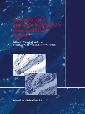 Obrázek produktu pro Cerebral Amyloid Angiopathy in Alzheimer's Disease and Related Disorders