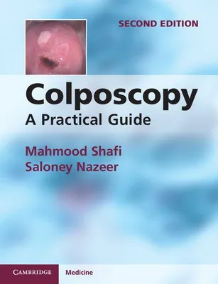 Produktbild von Colposcopy