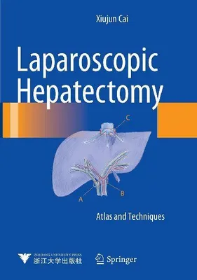 Produktbild von Laparoscopic Hepatectomy