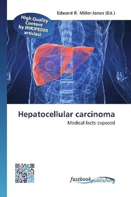 Produktbild von Hepatocellular carcinoma