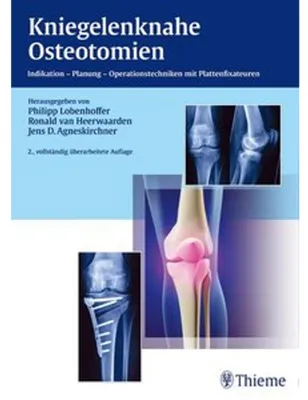 Produktbild von Kniegelenknahe Osteotomien