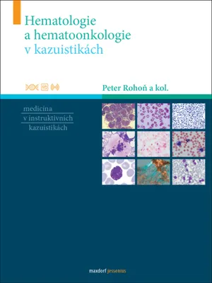 Zdjęcie produktu dla Hematologie a hematoonkologie v kazuistikách (Rohoň Peter)