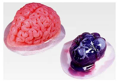 Produktbild von Puddingform Set Gehirn und Herz