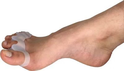 Produktbild von scarlet health | Zehenspreizer »Spreader III«; 1 Paar (2 Stück) Gelstütze aus weichem Silikon; 5-Zehenspreizer bei Hallux Valgus, Hammerzehen, Ballenzehen, Farbe:Transparent