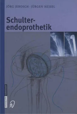 Produktbild von Schulterendoprothetik