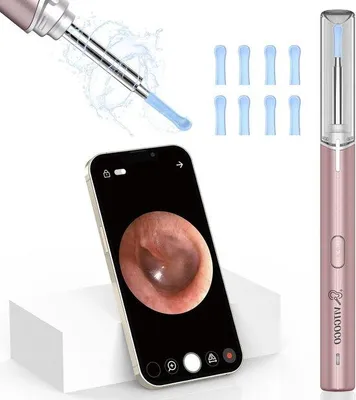 Image de Caméra 1920P WiFi pour le nettoyage des oreilles, étanche IP67, grand angle 360°, 6 LED