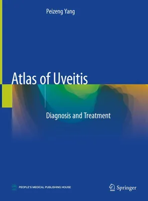 Produktbild von Atlas of Uveitis