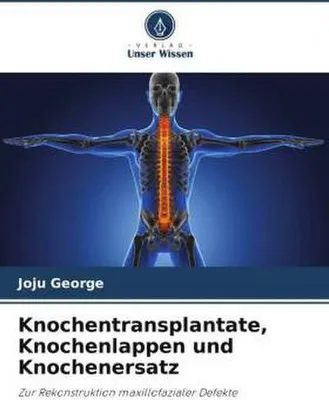 Produktbild von Knochentransplantate, Knochenlappen und Knochenersatz