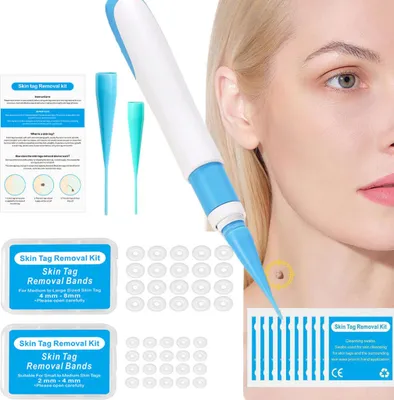 Produktbild von Schnell-Entfernungsset, Kit zur Entfernung von Hautflecken, sicheres und schmerzloses, schmerzloses Gerät zur Entfernung von Stammwarzen