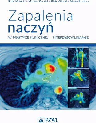 Image de Zapalenia naczyń w praktyce klinicznej interdyscyplinarnie