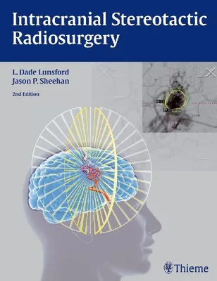 Produktbild von Intracranial Stereotactic Radiosurgery