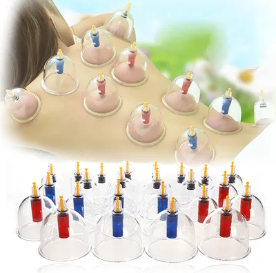 Produktbild von Schröpfen Set mit 24 Schröpfgläser aus Kunststoff Schröpfen Set Vakuum Massage Schröpfset