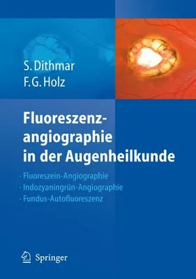 Obrázok produktu pre Fluoreszenzangiographie in der Augenheilkunde
