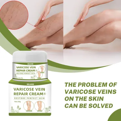Produktbild von 50g Krampfadern Creme Varicose Veins Creme gegen Besenreiser, Krampfadern und Besenreiser Entfernen, Varicose Veins, Beine Care Salbe