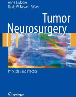 Immagine prodotto di Tumor Neurosurgery