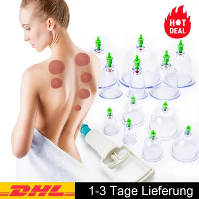 Produktbild von Schröpftherapie-Set, 12-Tassen-Vakuum-Schröpfset mit Vakuumpumpe für die Körpermasse