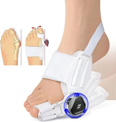 Produktbild von Hallux Valgus Korrektur Set, Verstellbare Hallux Valgus Schiene mit Knaufkorrektur, zehenspreizer, Universal Linker und Rechter Fuß - Weiß（1 stück）