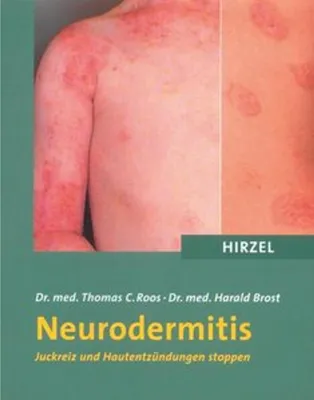 Produktbild von Neurodermitis