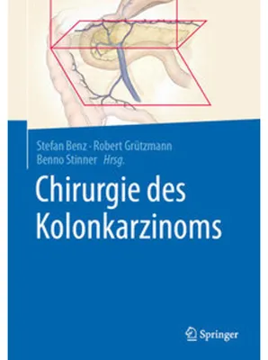 Image de Chirurgie des Kolonkarzinoms