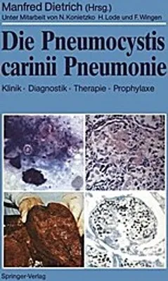 Obrázek produktu pro Die Pneumocystis carinii Pneumonie