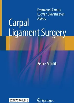 Zdjęcie produktu dla Carpal Ligament Surgery