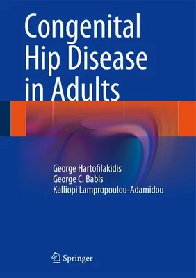 Produktbild von Congenital Hip Disease in Adults