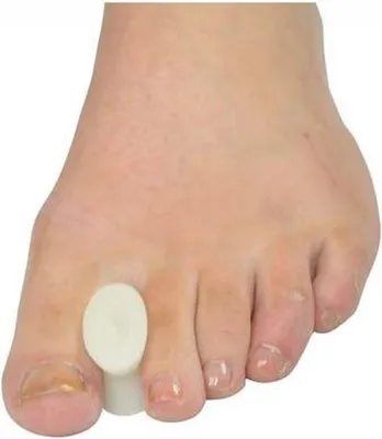 Produktbild von CHPN - Zehenspreizer - Hallux Valgus - Silikon - Zehenspreizer - Zehenkorrektor - 2 Stück - Perfekte Lösung für Hallux Valgus - Universell